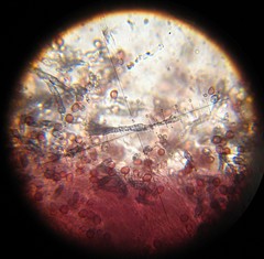 Hypochnella violacea