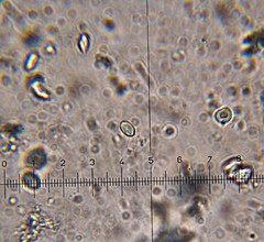 Verrucosporaceae
