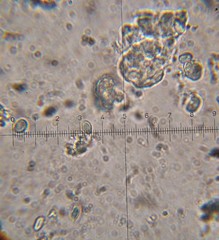 Verrucosporaceae