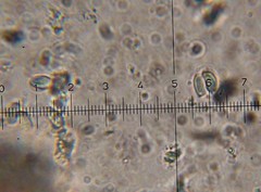 Verrucosporaceae