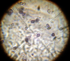 Melanoleuca exscissa