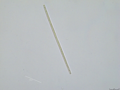 Aphanizomenon flosaquae