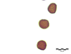 Fossombronia pusilla