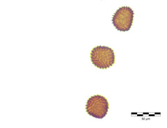 Fossombronia pusilla