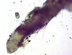 Fossombronia pusilla