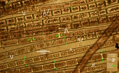 Zygogonium ericetorum