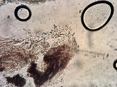 Naetrocymbe punctiformis