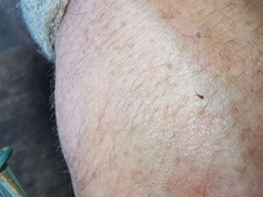 Heterotoma planicornis