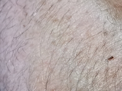 Heterotoma planicornis