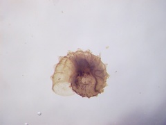 Gyraulus crista