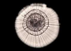 Actinosphaerium