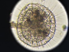 Actinosphaerium
