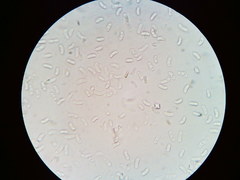 Peniophora violaceolivida