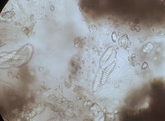 Topeliopsis decorticans