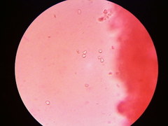 Trechispora mollusca