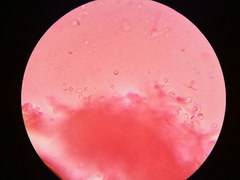 Trechispora mollusca