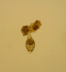 Philodina megalotrocha