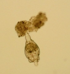 Philodina megalotrocha