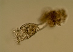 Philodina megalotrocha