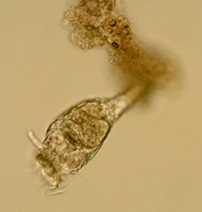 Philodina megalotrocha