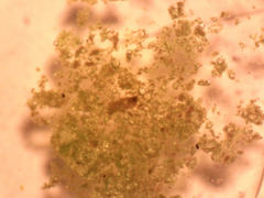 Botrydiopsis