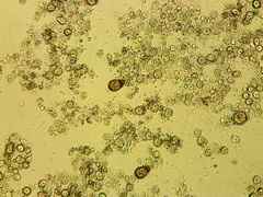 Botrydiopsis