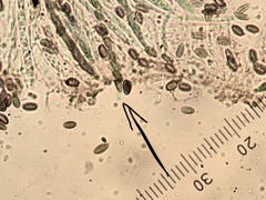 Chaenothecopsis savonica