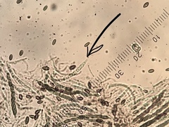 Chaenothecopsis savonica