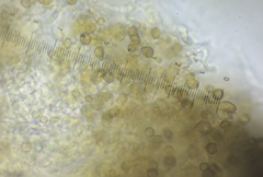 Chaenotheca trichialis