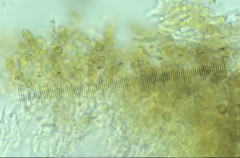 Chaenotheca trichialis