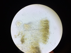 Chaenotheca trichialis