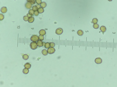 Chaenotheca trichialis