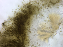 Chaenotheca trichialis