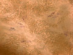 Rhizopogon semitectus