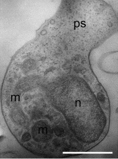 Aphelidea