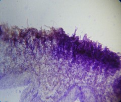 Camarophyllopsis