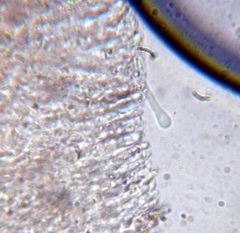 Lyophyllaceae