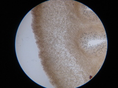 Lyophyllaceae