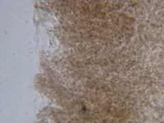 Lyophyllaceae