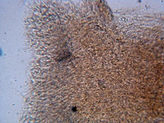 Lyophyllaceae