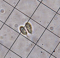 Lyophyllaceae
