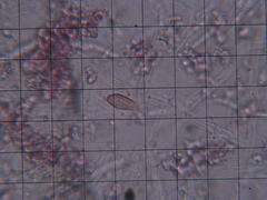 Hypochnella violacea