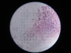 Hypochnella violacea