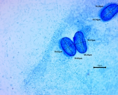 Scutellinia olivascens