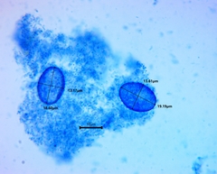 Scutellinia olivascens