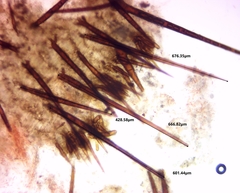 Scutellinia olivascens