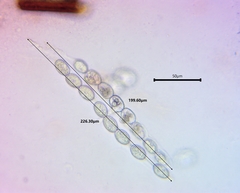 Scutellinia olivascens