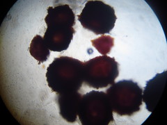 Nectria pseudotrichia