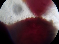 Nectria pseudotrichia