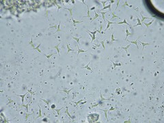 Cornutispora ciliata